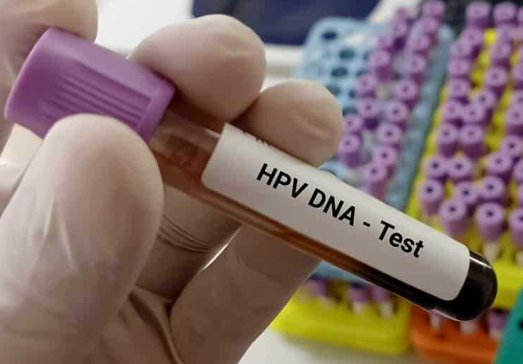 Hpv testi nasıl yapılır