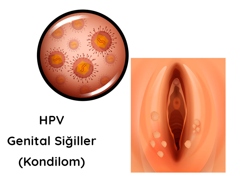 hpv-görüntüleri